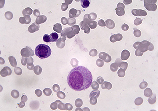 血細(xì)胞成像 - TrueChrome HDMI 相機(jī)